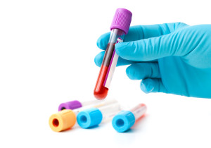 picture of hand holding blood for fertility tests, infertility testing