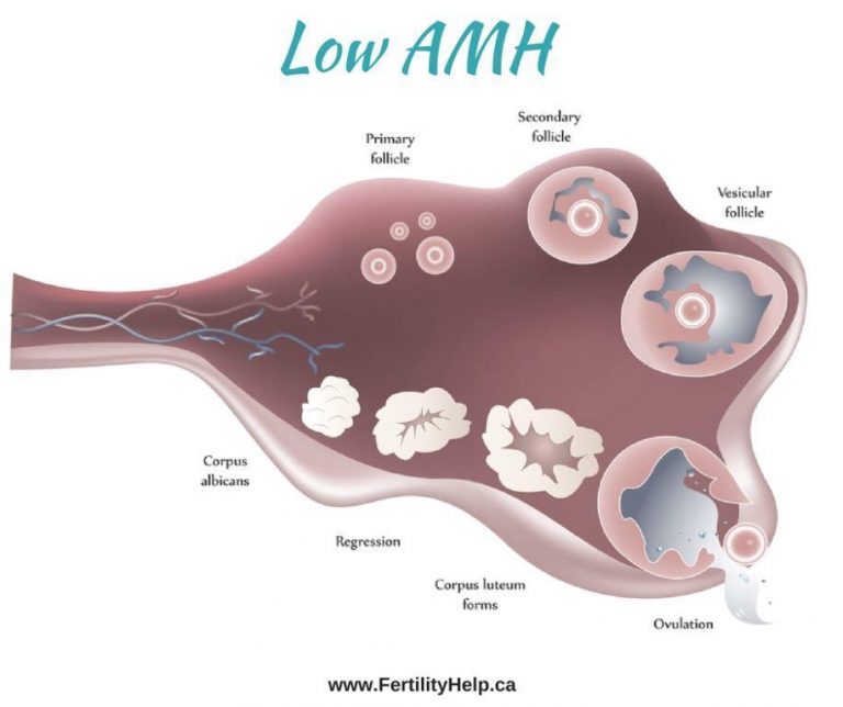 low-amh-or-anti-mullerian-hormone-what-does-it-mean